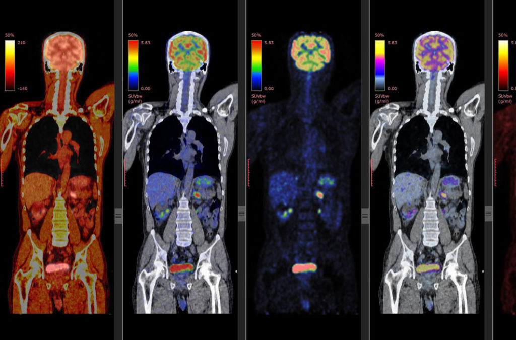 premier-radiology-tennessee-pet-ct